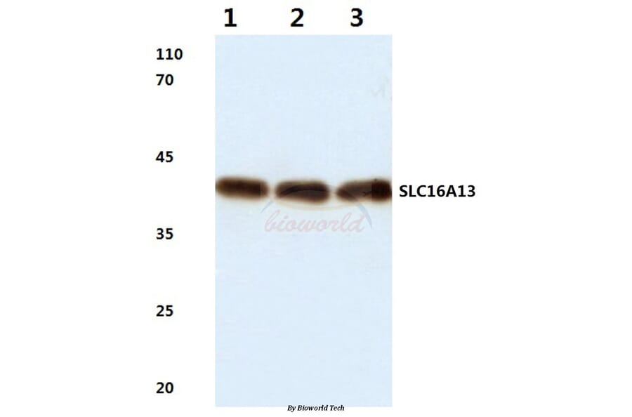 Anti-SLC16A13 (L423) Antibody from Bioworld Technology (BS3143) - Antibodies.com