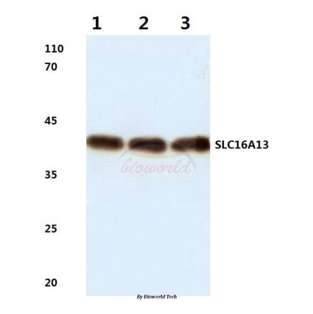 Anti-SLC16A13 (L423) Antibody from Bioworld Technology (BS3143) - Antibodies.com