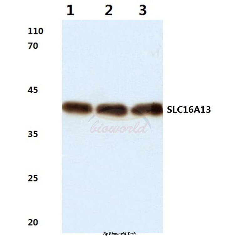 Anti-SLC16A13 (L423) Antibody from Bioworld Technology (BS3143) - Antibodies.com