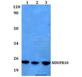 Anti-NDUFB10 (E95) Antibody from Bioworld Technology (BS3146) - Antibodies.com