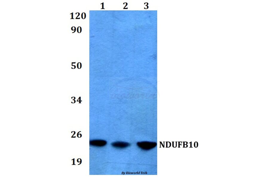 Anti-NDUFB10 (E95) Antibody from Bioworld Technology (BS3146) - Antibodies.com