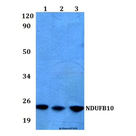 Anti-NDUFB10 (E95) Antibody from Bioworld Technology (BS3146) - Antibodies.com