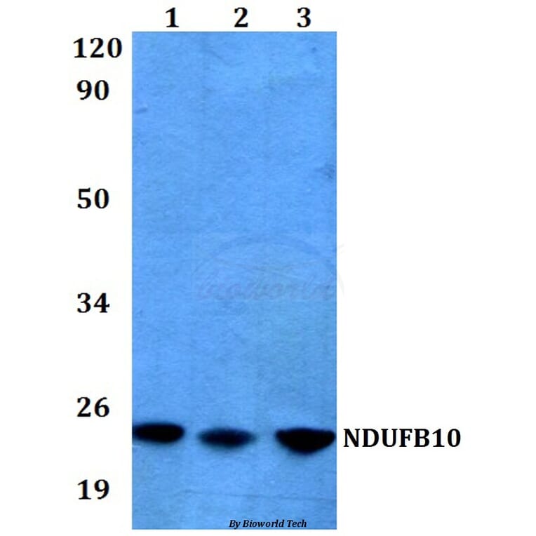 Anti-NDUFB10 (E95) Antibody from Bioworld Technology (BS3146) - Antibodies.com