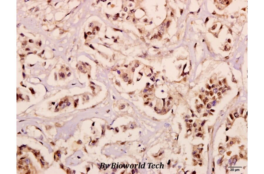 Anti-NDUFB10 (E95) Antibody from Bioworld Technology (BS3146) - Antibodies.com