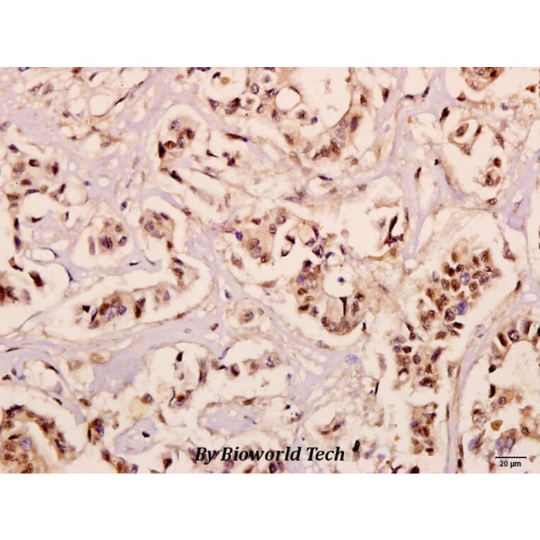 Anti-NDUFB10 (E95) Antibody from Bioworld Technology (BS3146) - Antibodies.com