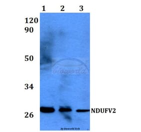 Anti-NDUFV2 (P52) Antibody from Bioworld Technology (BS3147) - Antibodies.com