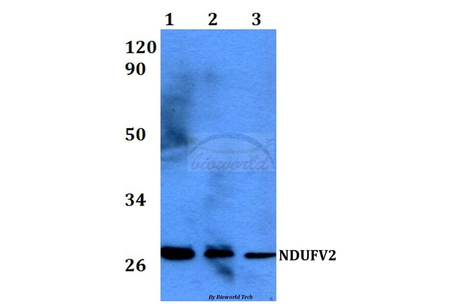 Anti-NDUFV2 (P52) Antibody from Bioworld Technology (BS3147) - Antibodies.com