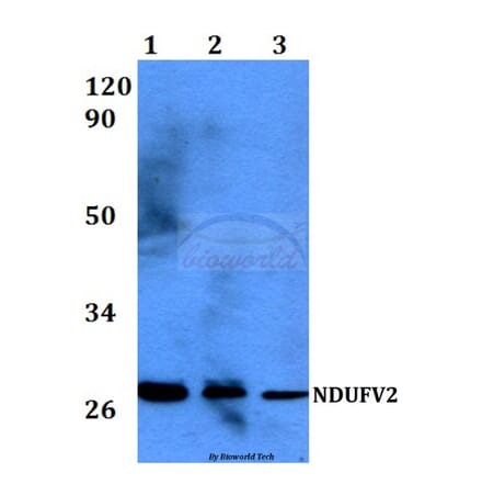 Anti-NDUFV2 (P52) Antibody from Bioworld Technology (BS3147) - Antibodies.com