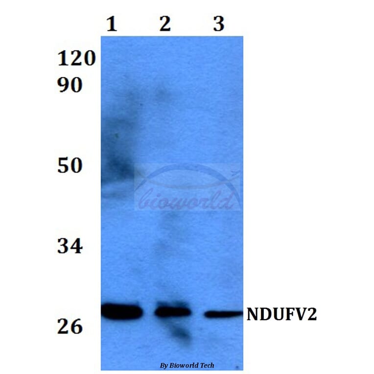 Anti-NDUFV2 (P52) Antibody from Bioworld Technology (BS3147) - Antibodies.com