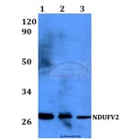 Anti-NDUFV2 (P52) Antibody from Bioworld Technology (BS3147) - Antibodies.com