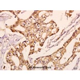Anti-NDUFV2 (P52) Antibody from Bioworld Technology (BS3147) - Antibodies.com
