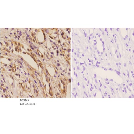 Anti-NXF3 (N104) Antibody from Bioworld Technology (BS3149) - Antibodies.com