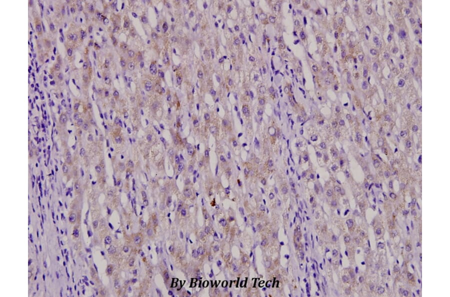 Anti-PAI-3 (L291) Antibody from Bioworld Technology (BS3152) - Antibodies.com