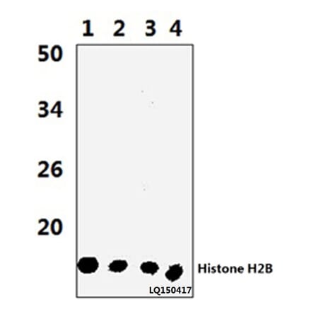 Anti-Histone H2B (P8) Antibody from Bioworld Technology (BS3153) - Antibodies.com