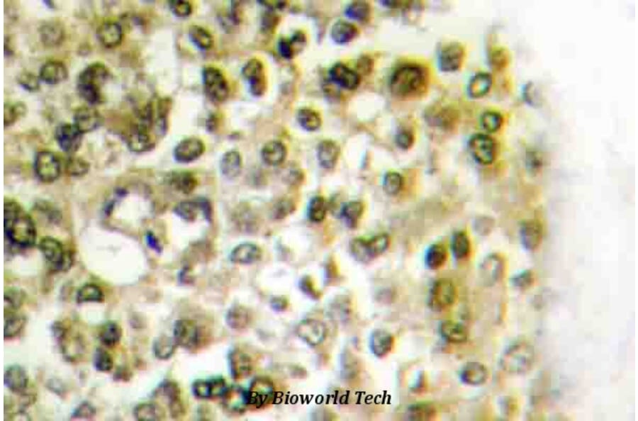 Anti-Histone H2B (P8) Antibody from Bioworld Technology (BS3153) - Antibodies.com