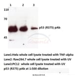 Anti-p53 (R375) Antibody from Bioworld Technology (BS3156) - Antibodies.com