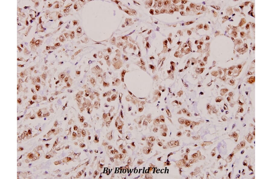 Anti-p53 (R375) Antibody from Bioworld Technology (BS3156) - Antibodies.com