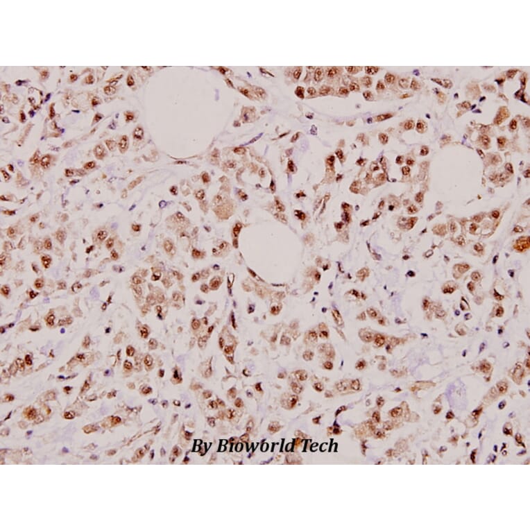 Anti-p53 (R375) Antibody from Bioworld Technology (BS3156) - Antibodies.com