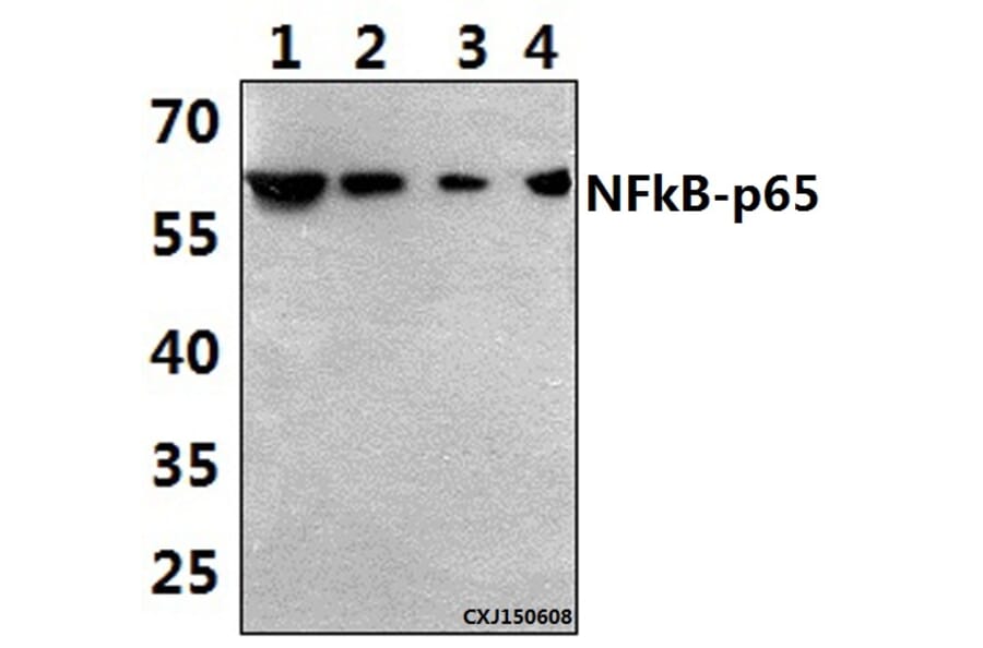 Anti-NFkB-p65 (K303) Antibody from Bioworld Technology (BS3157) - Antibodies.com