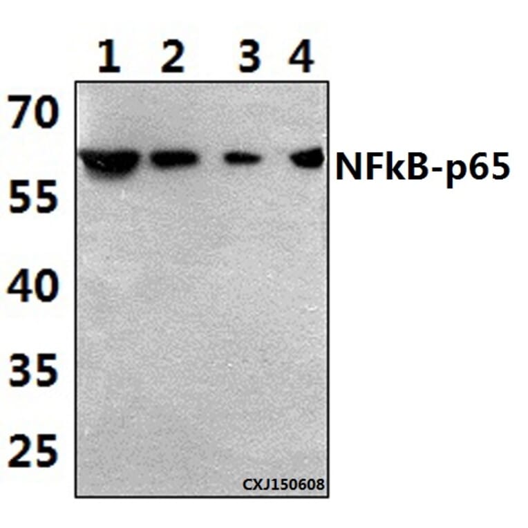 Anti-NFkB-p65 (K303) Antibody from Bioworld Technology (BS3157) - Antibodies.com