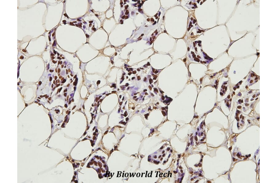 Anti-NFkB-p65 (K303) Antibody from Bioworld Technology (BS3157) - Antibodies.com