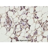 Anti-NFkB-p65 (K303) Antibody from Bioworld Technology (BS3157) - Antibodies.com