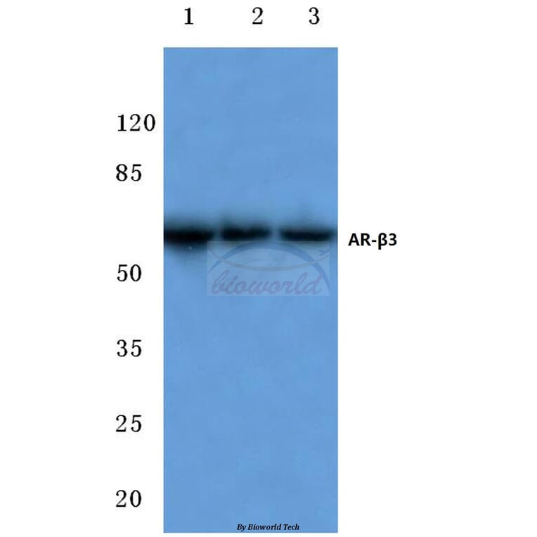 Anti-AR-β3 (L291) Antibody from Bioworld Technology (BS3158) - Antibodies.com