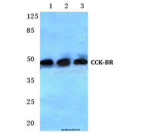 Anti-CCK-BR (L54) Antibody from Bioworld Technology (BS3159) - Antibodies.com