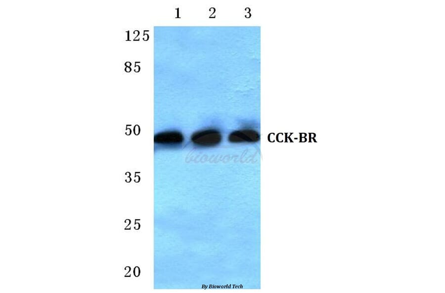 Anti-CCK-BR (L54) Antibody from Bioworld Technology (BS3159) - Antibodies.com
