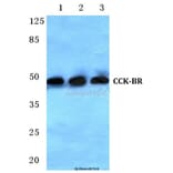 Anti-CCK-BR (L54) Antibody from Bioworld Technology (BS3159) - Antibodies.com