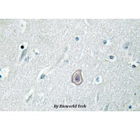 Anti-EP3 (R39) Antibody from Bioworld Technology (BS3162) - Antibodies.com