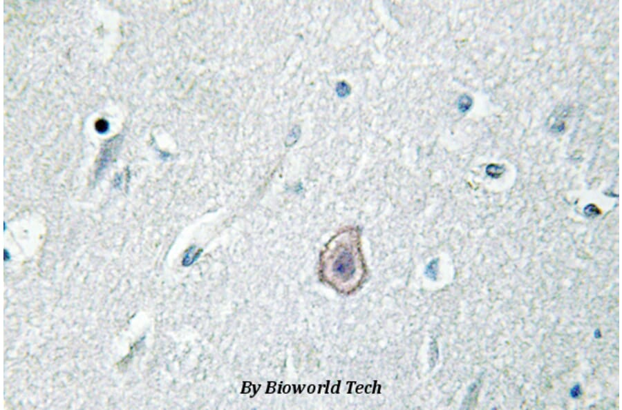Anti-EP3 (R39) Antibody from Bioworld Technology (BS3162) - Antibodies.com