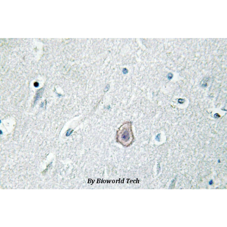 Anti-EP3 (R39) Antibody from Bioworld Technology (BS3162) - Antibodies.com
