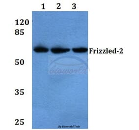 Anti-Frizzled-2 (E240) Antibody from Bioworld Technology (BS3163) - Antibodies.com