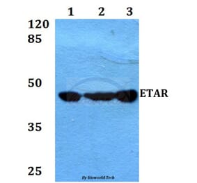 Anti-ETAR (D424) Antibody from Bioworld Technology (BS3165) - Antibodies.com