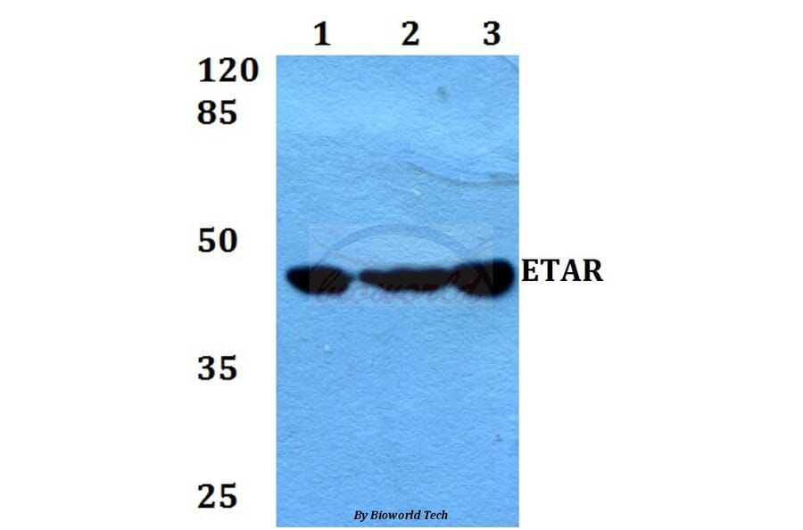 Anti-ETAR (D424) Antibody from Bioworld Technology (BS3165) - Antibodies.com