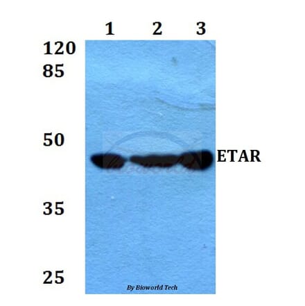 Anti-ETAR (D424) Antibody from Bioworld Technology (BS3165) - Antibodies.com