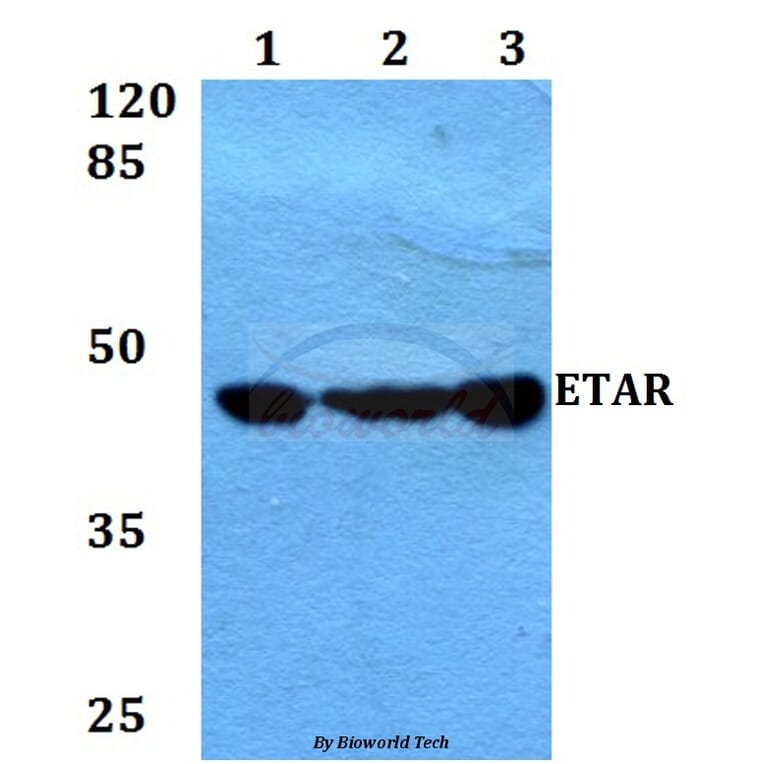 Anti-ETAR (D424) Antibody from Bioworld Technology (BS3165) - Antibodies.com