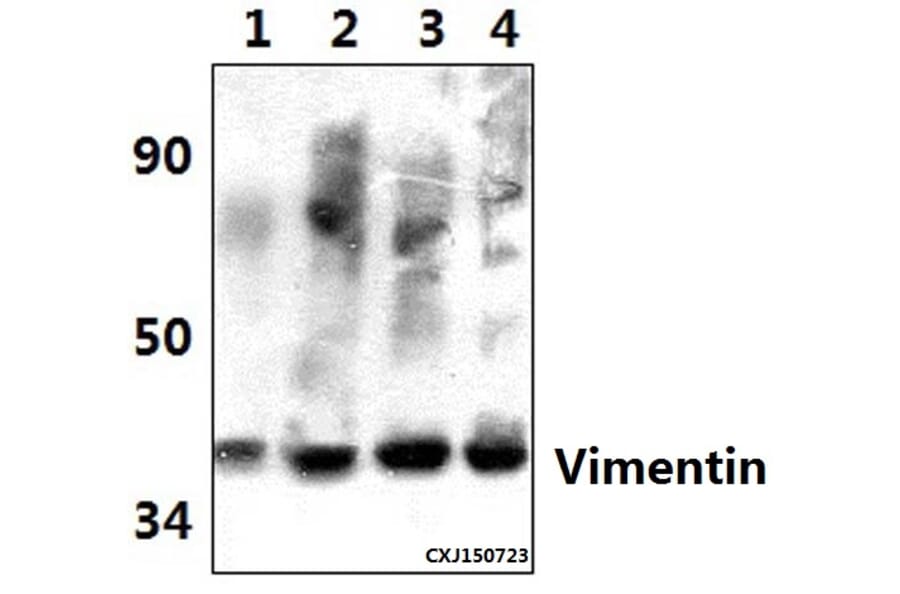 Anti-Vimentin (S55) Antibody from Bioworld Technology (BS3182) - Antibodies.com