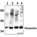 Anti-Vimentin (S55) Antibody from Bioworld Technology (BS3182) - Antibodies.com
