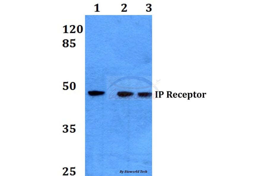 Anti-IP Receptor (H237) Antibody from Bioworld Technology (BS3196) - Antibodies.com