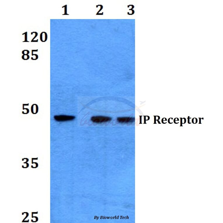 Anti-IP Receptor (H237) Antibody from Bioworld Technology (BS3196) - Antibodies.com