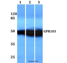 Anti-GPR103 (I310) Antibody from Bioworld Technology (BS3198) - Antibodies.com