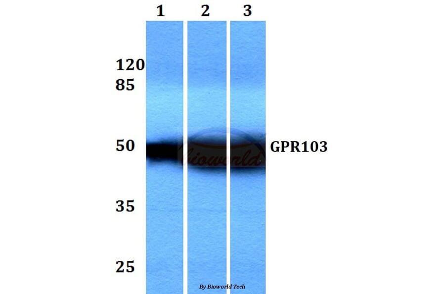 Anti-GPR103 (I310) Antibody from Bioworld Technology (BS3198) - Antibodies.com