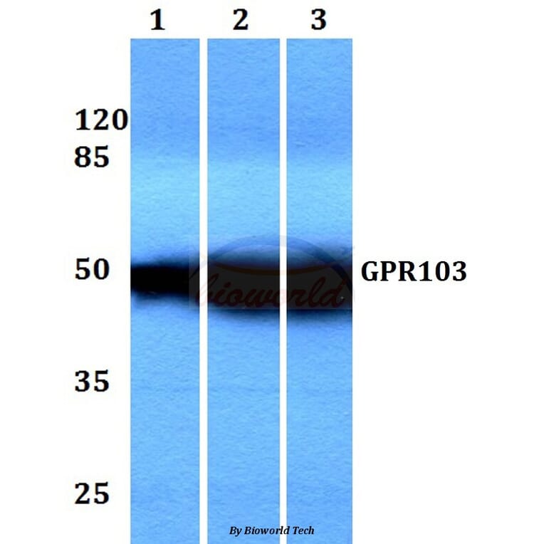 Anti-GPR103 (I310) Antibody from Bioworld Technology (BS3198) - Antibodies.com