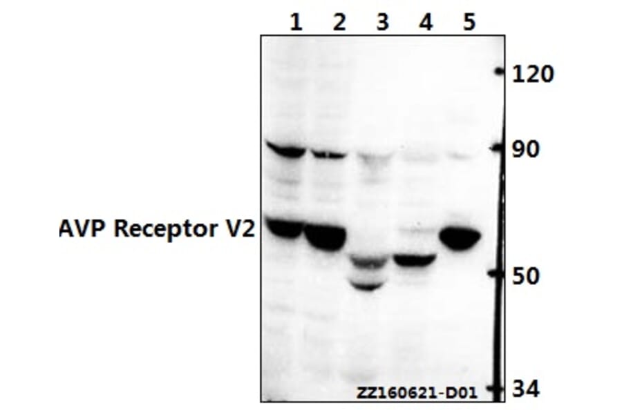 Anti-AVP Receptor V2 (L111) Antibody from Bioworld Technology (BS3210) - Antibodies.com