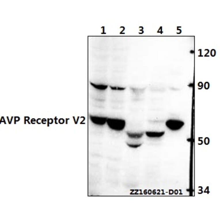 Anti-AVP Receptor V2 (L111) Antibody from Bioworld Technology (BS3210) - Antibodies.com
