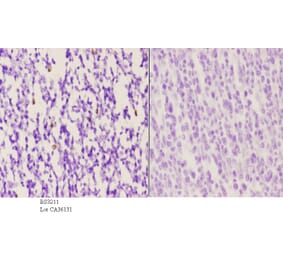 Anti-VPAC1 (V371) Antibody from Bioworld Technology (BS3211) - Antibodies.com