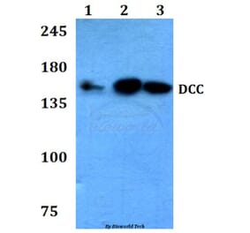 Anti-DCC (F465) Antibody from Bioworld Technology (BS3232) - Antibodies.com