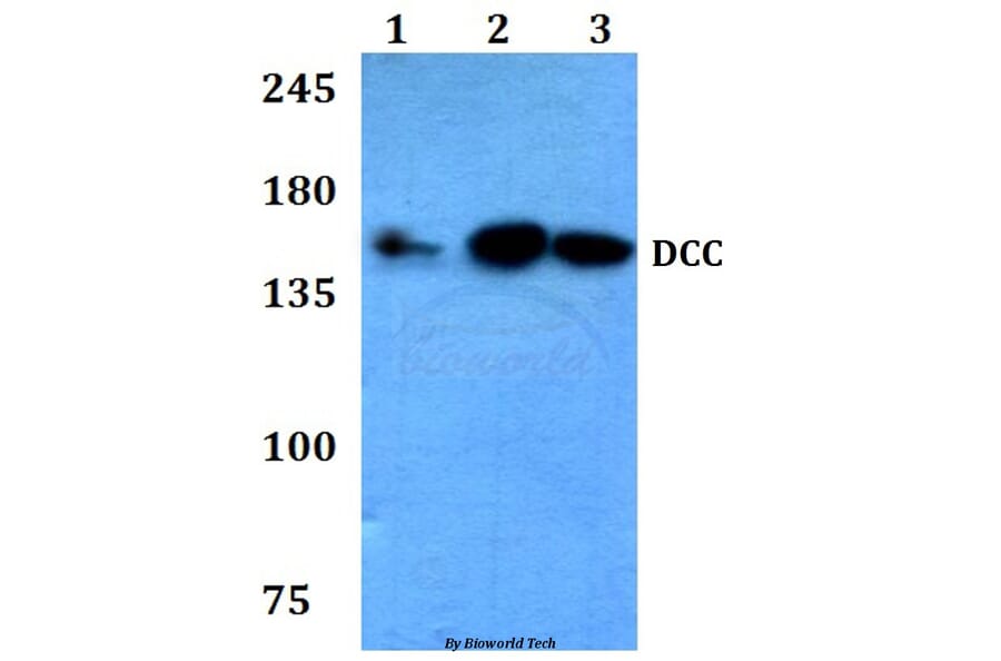 Anti-DCC (F465) Antibody from Bioworld Technology (BS3232) - Antibodies.com